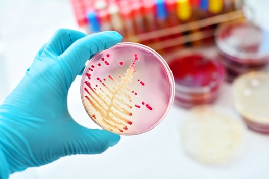 Technician streaking a petri dish in a lab for microbiological testing.